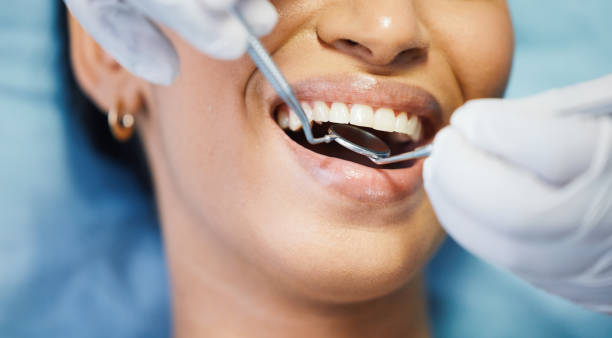 Best Emergency Treatment for Dental Infections or Abscesses in Suwanee, GA